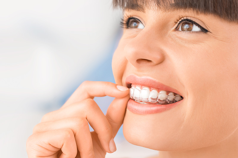 Breeze Dental Special Offer