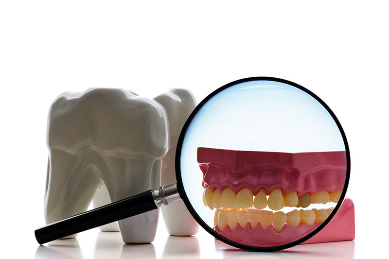 Root Canal in Fairfax